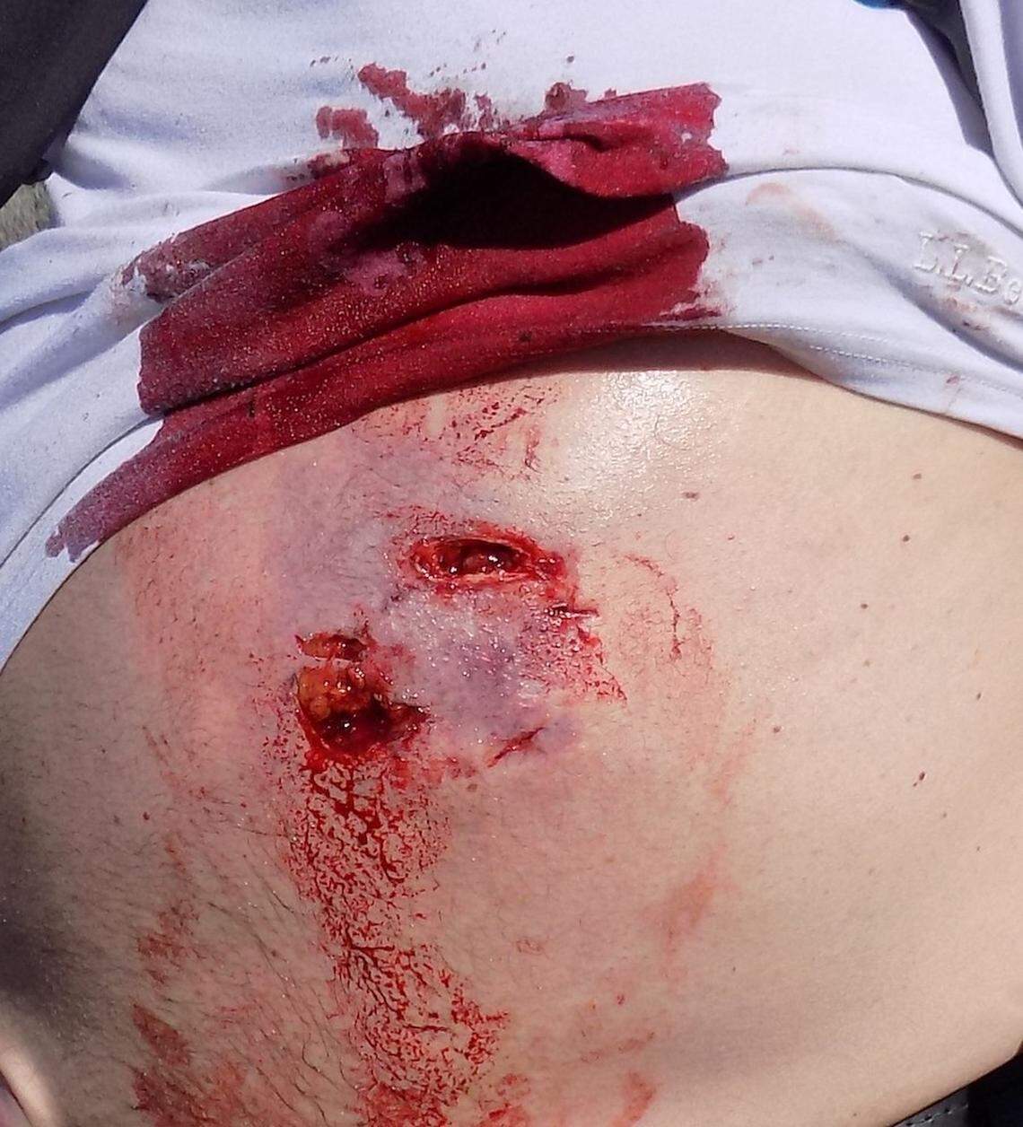 Gregory ‘Thor’ Godar was attacked by a bear while hiking with his wife in Henrys Lake State Park on May 29.