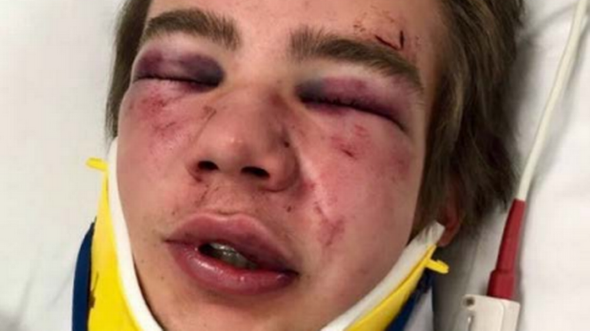 Boise State University freshman Ben Taylor says he was beaten by football player Jace Richter.