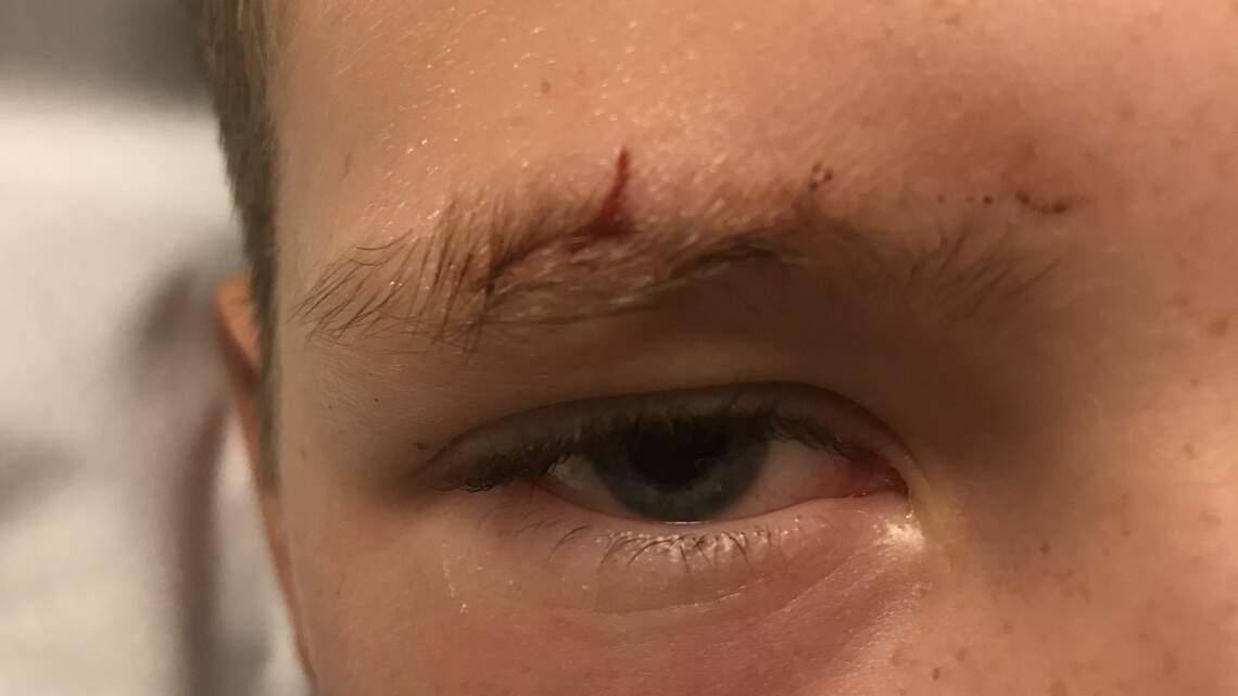 A dog bit my child’s face and I didn’t know what to do. Here’s what I learned.
