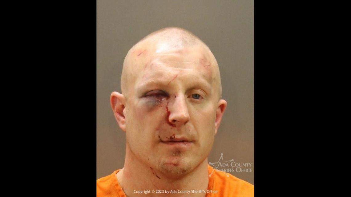 The booking photo for Colt James Seward shows the effects of a beating he received while being arrested by Meridian police.