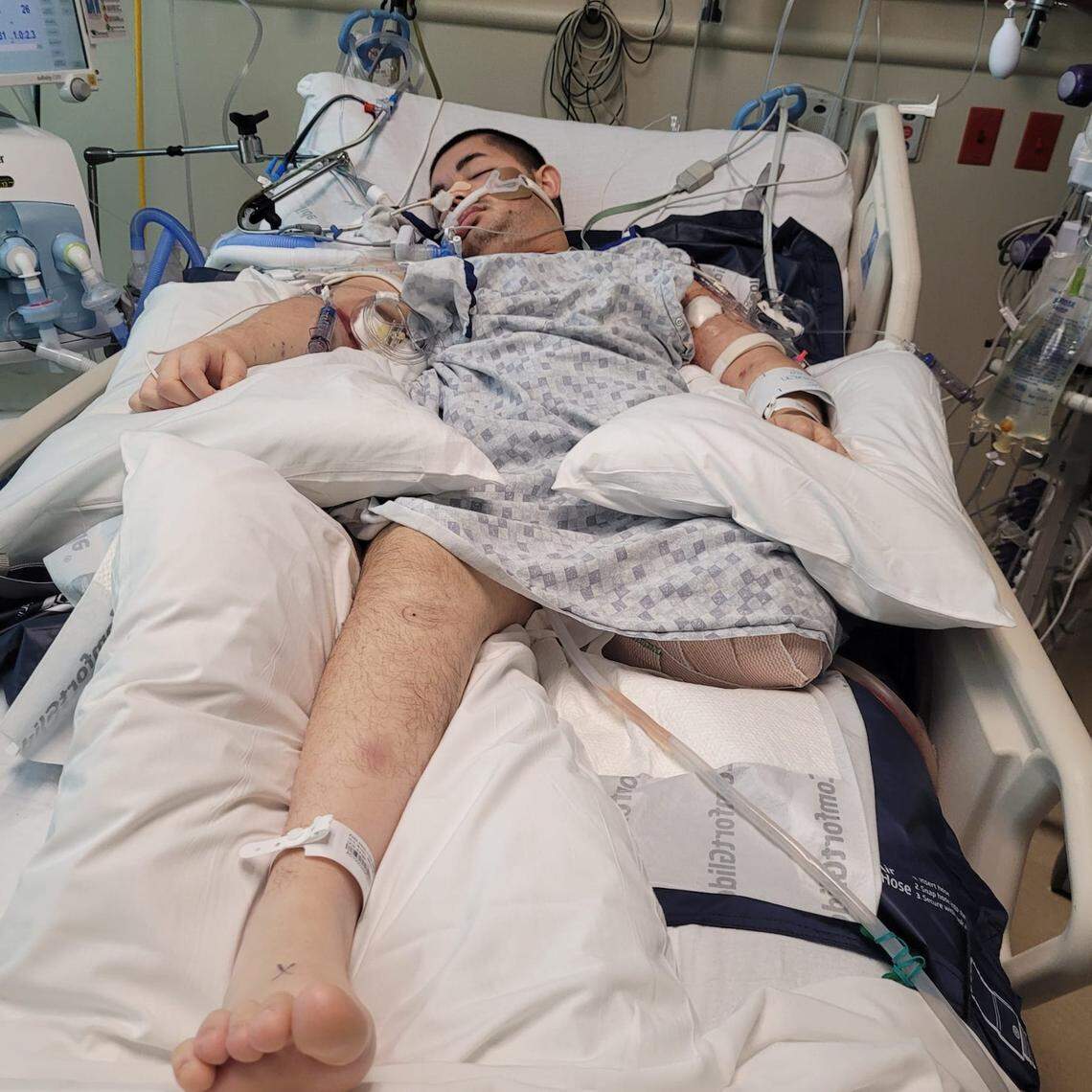 Victor Perez was hospitalized for a week and underwent a leg amputation after he was shot by four officers from the Pocatello Police Department. Testing showed he didn’t have any brain activity and his family removed him off of life support Saturday. 