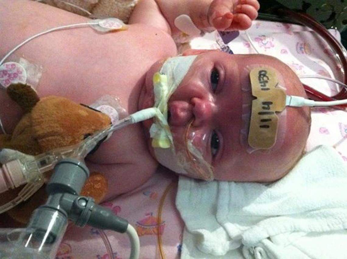A baby with pertussis receives treatment in a hospital to aid with breathing.