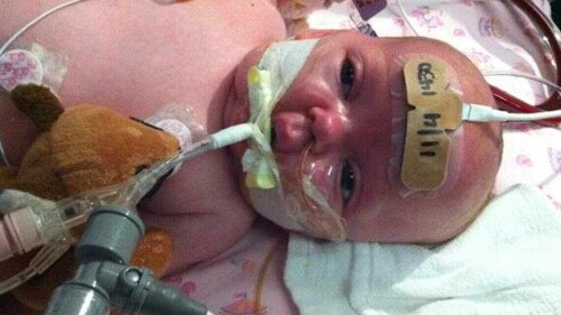 Whooping cough outbreak in North Idaho: With low vaccination rates, what can we do? | Opinion