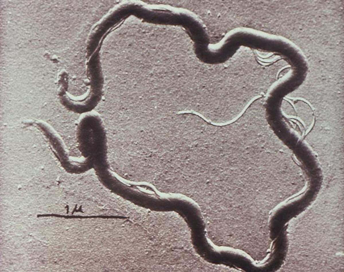 A microscopic image of Treponema pallidum spirochete, the causative agent of syphilis.