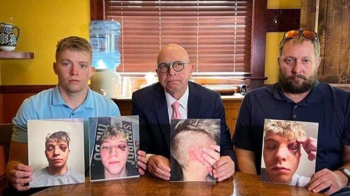 Timmy Reed, left, attorney Tim Gresback and Timmy’s father, Nick Reed, hold photos of Timmy that show his injuries after a large fight in February.
