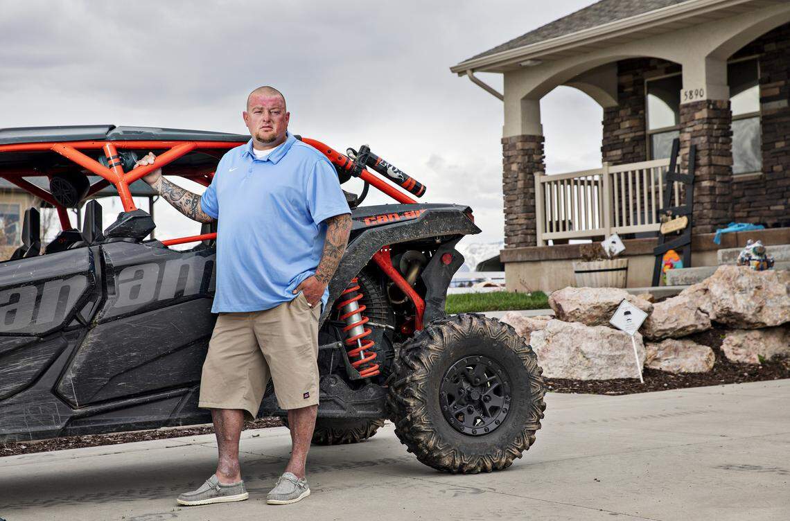 After extensive skin grafts, construction worker John Hill still deals with pain from the burns he sustained after his RZR burst into flames in 2014 in St. Anthony, Idaho. But last year, he bought a new side-by-side vehicle -- the Can-Am Maverick, shown at left.