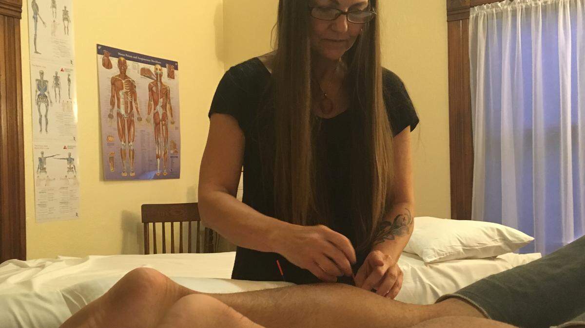 Dana Logan places acupuncture needles on a Boise State football player Tuesday.