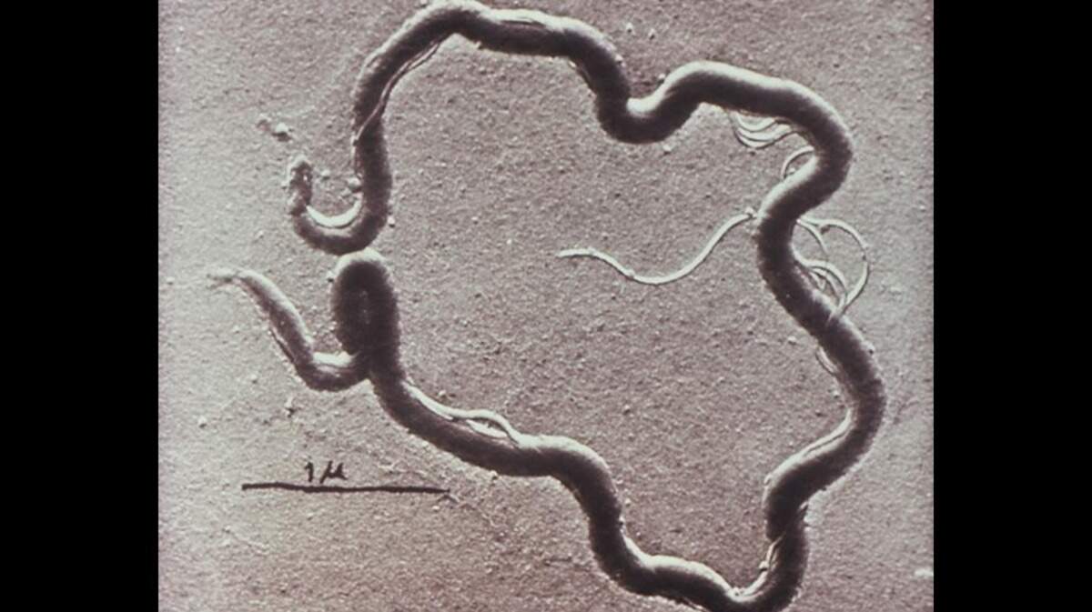This file photo shows a microscope image of the bacteria that causes syphilis.