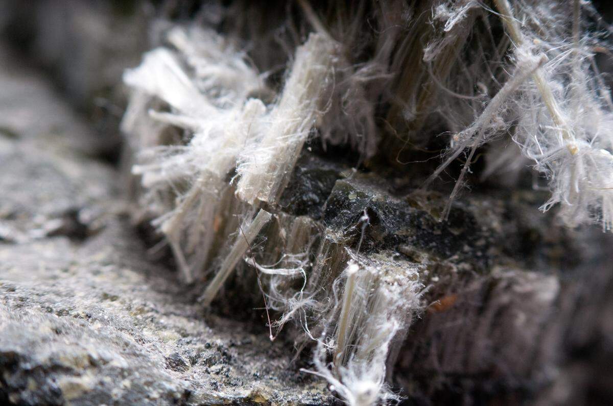 Asbestos chrysotile fibers can cause lung diseases, COPD, lung cancer and mesothelioma.