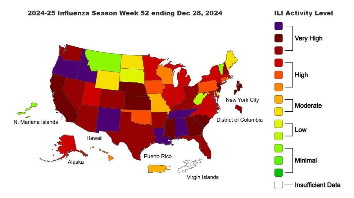 A graph from the Centers for Disease Control and Prevention categorizes flu activity in Idaho as “very high,” according to the latest data.