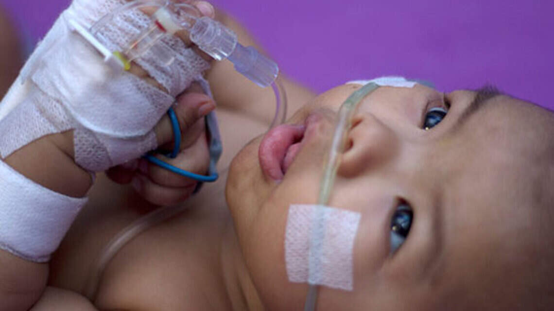 St. Luke’s Children’s Hospital reports sudden uptick in patients with respiratory virus