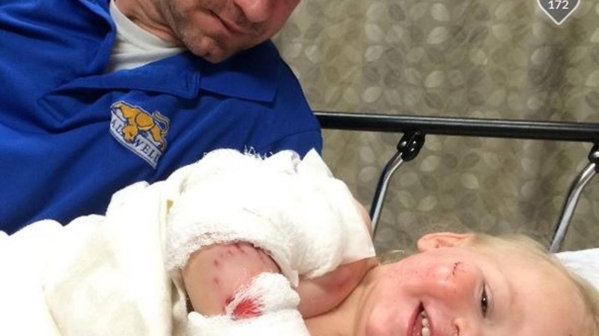 Riley Ireland is shown here with his father, Randy Ireland, after an April 27 mauling by a neighborhood dog while he was playing in his fenced yard.