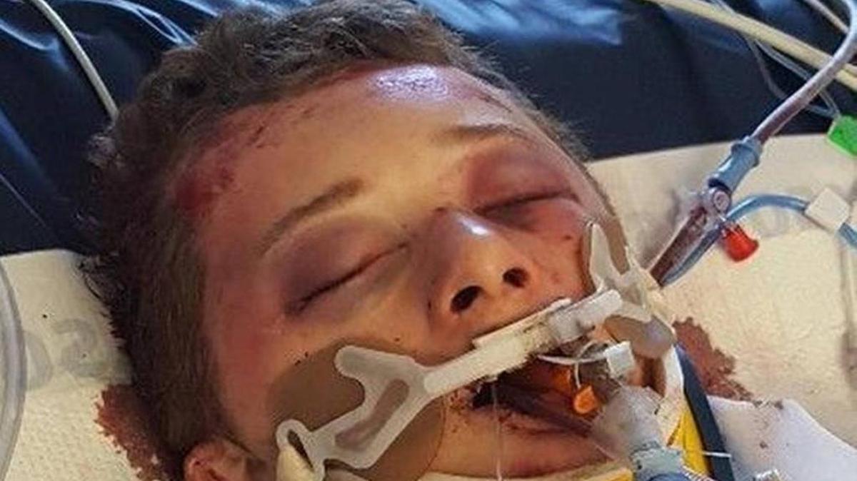 Jason Cooley Jr. was hospitalized with serious head injuries after he was attacked in a Nampa park in May of 2017.
