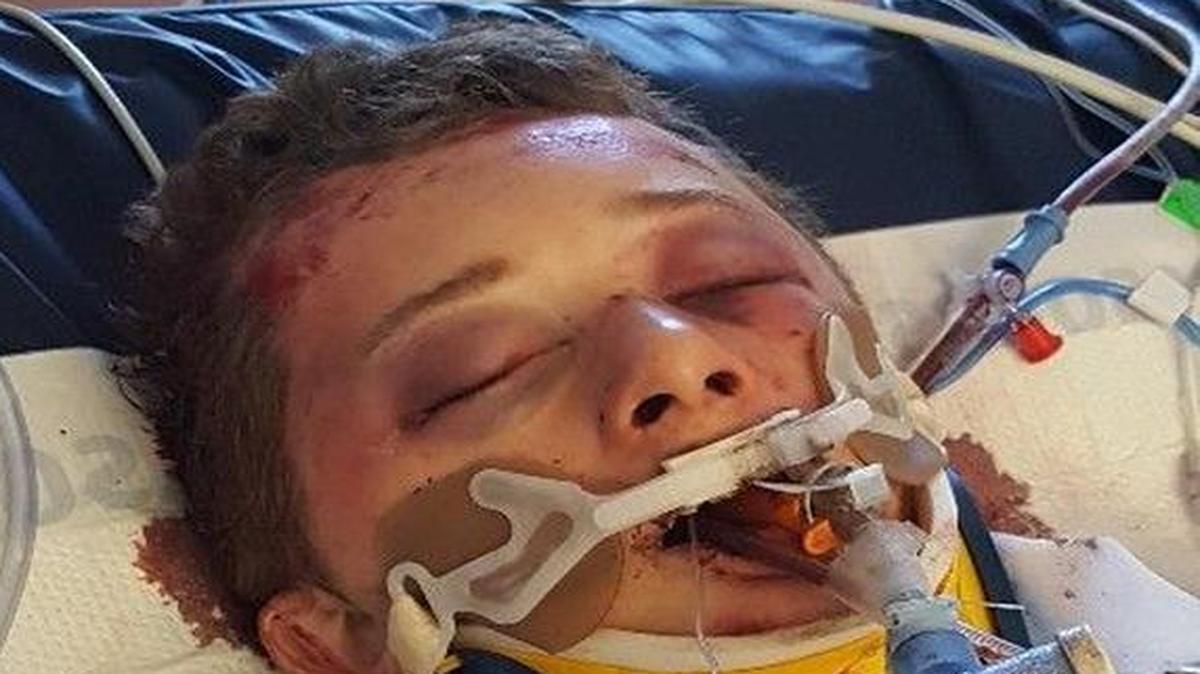 Jason Cooley was treated in the ICU at Saint Alphonsus Regional Medical Center in Boise.