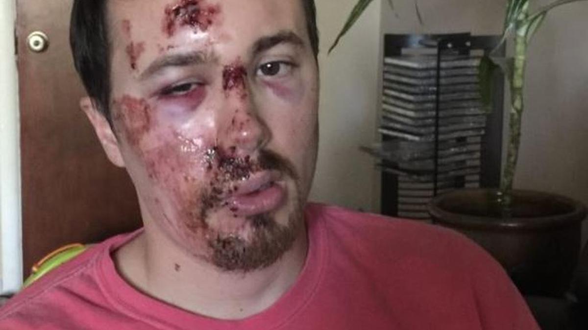 Supporters of Boise bicyclist Derrek Brent, who was serverely injured in a crash in Downtown Boise Monday have set up an online fundraising account for him. So far, seven people have donated about $300.