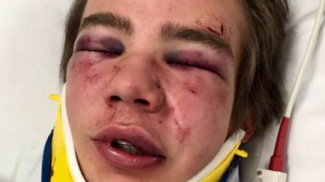 Witnesses say football player, student each threw punches in BSU dorm fight