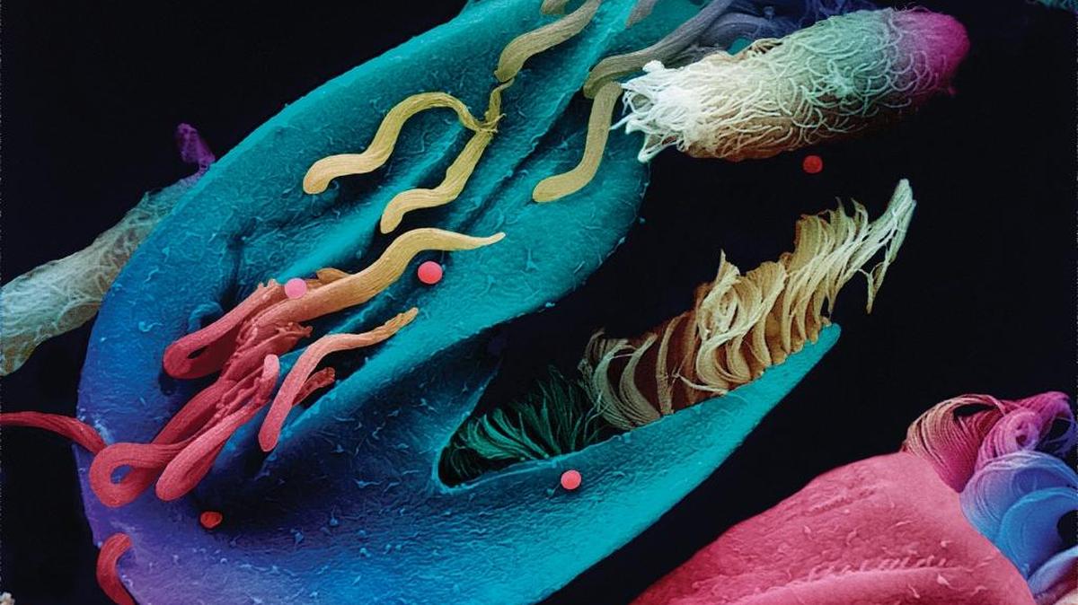 Euplotes protozoa scavenge ponds for bacteria. It’s one of the microorganisms in Steve Stuebner’s book, “Idaho Microbes.”