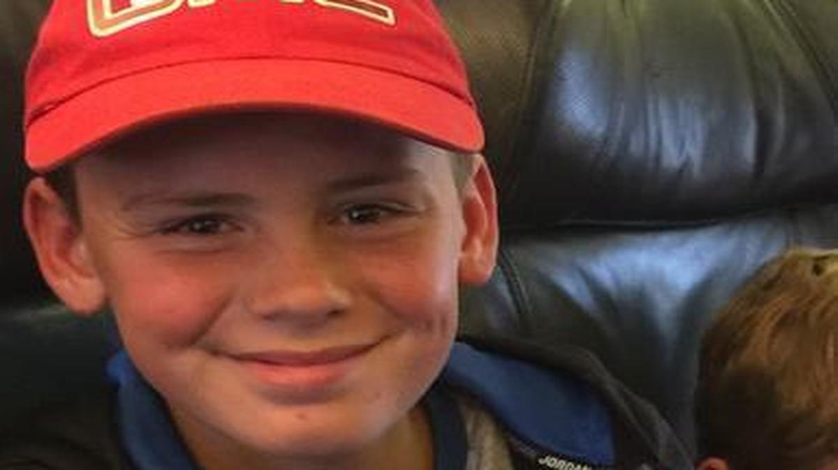 Braxton Bigelow was severely burned in an accident at his house Monday morning.