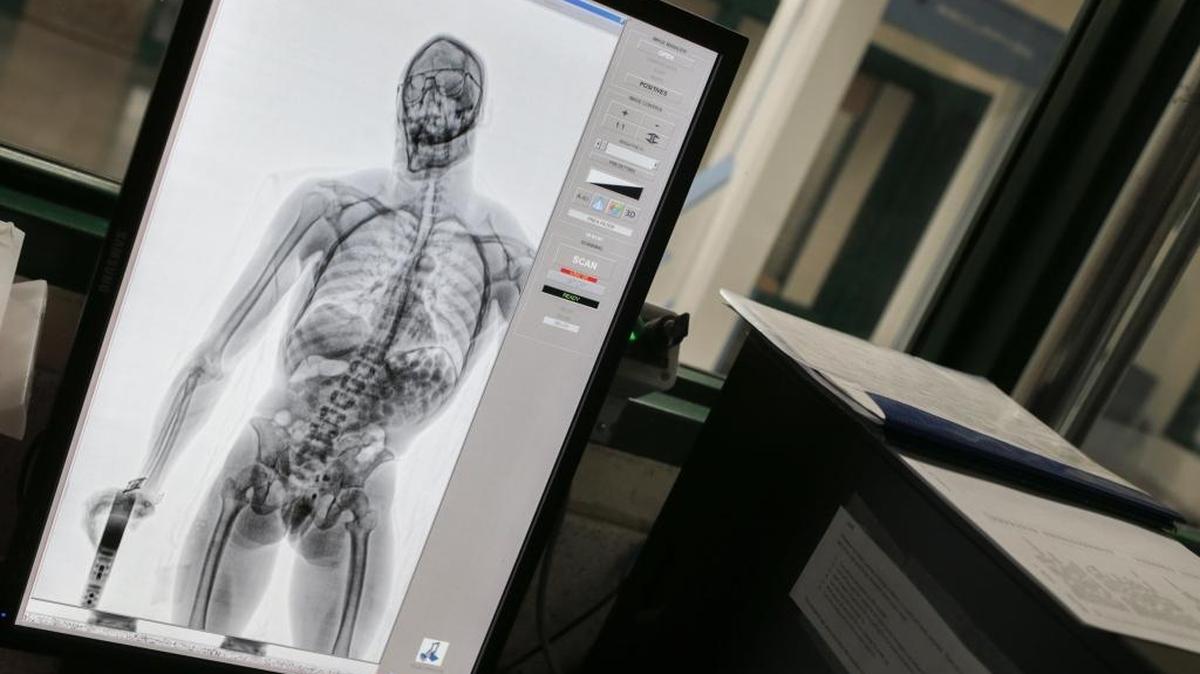 A display of a body scan, used for training, shows a suspect who was carrying roughly 60 balloons of narcotics in their stomach. The X-ray machine is in the background. All people being booked into the Bonneville County Jail must go through the full-body X-ray machine, which according to Lt. Michael Pickett emits the same amount of radiation as three hours worth of sunlight.