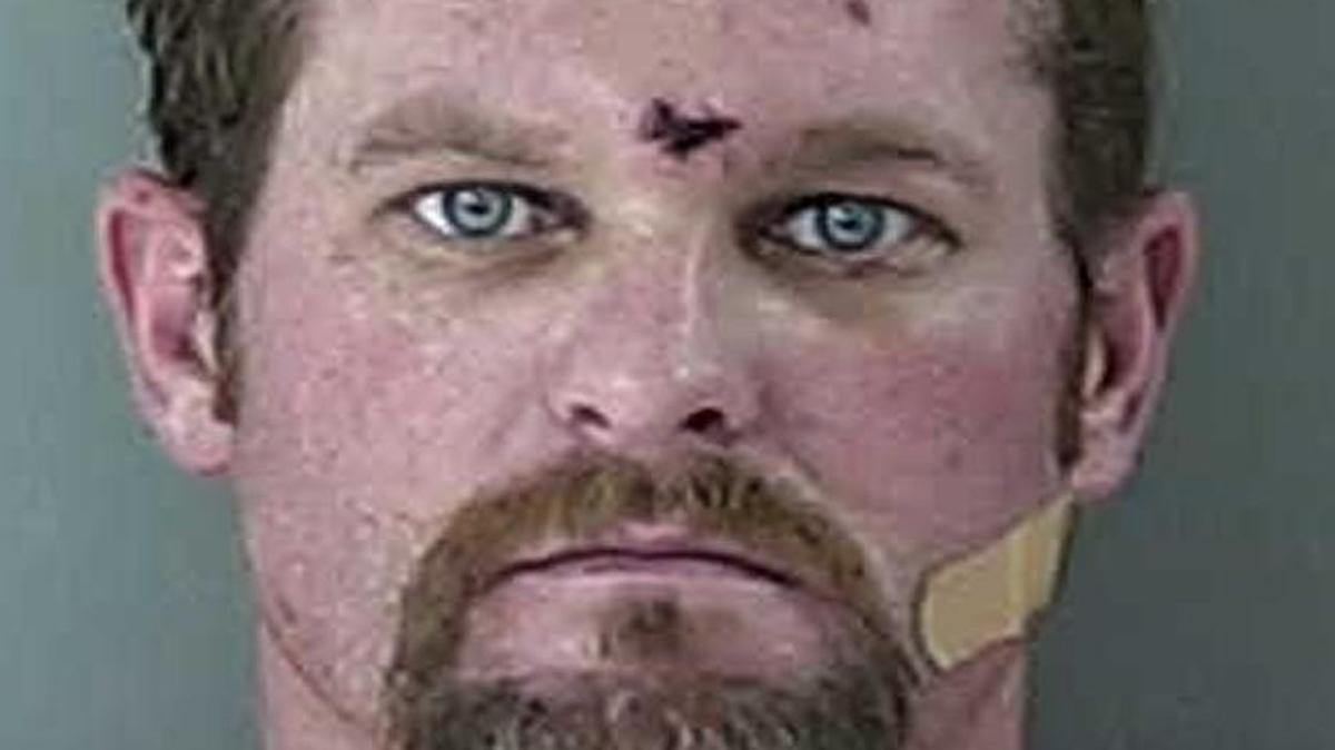 Dennis Barnes’ Twin Falls County Jail mugshot shows the wound his family argues is from a bullet fired by a sheriff’s sergeant.
